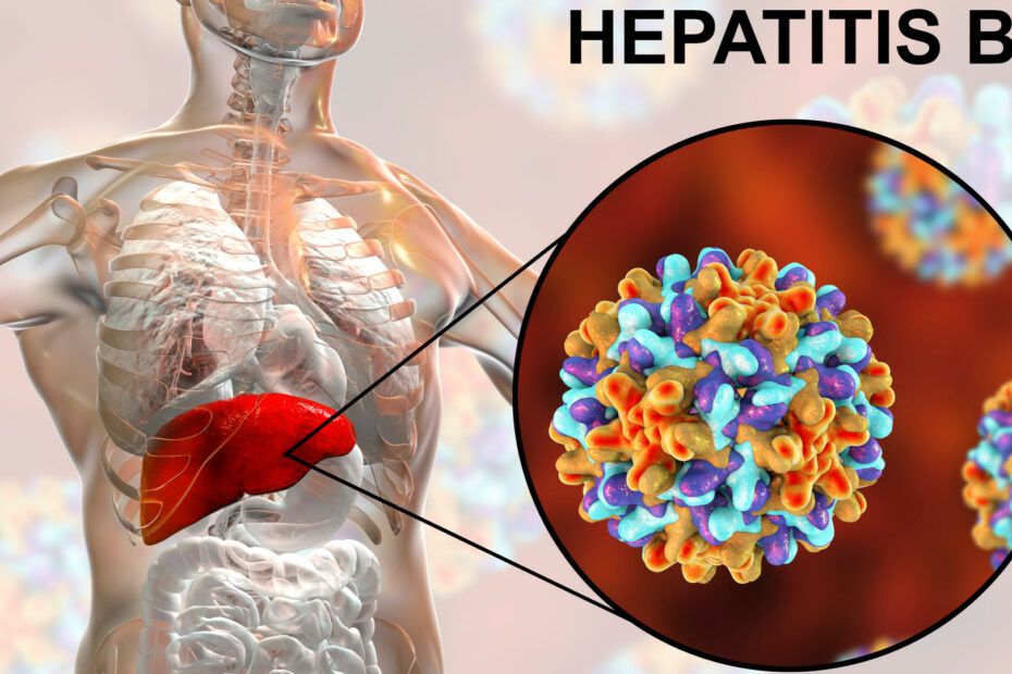 hepatita