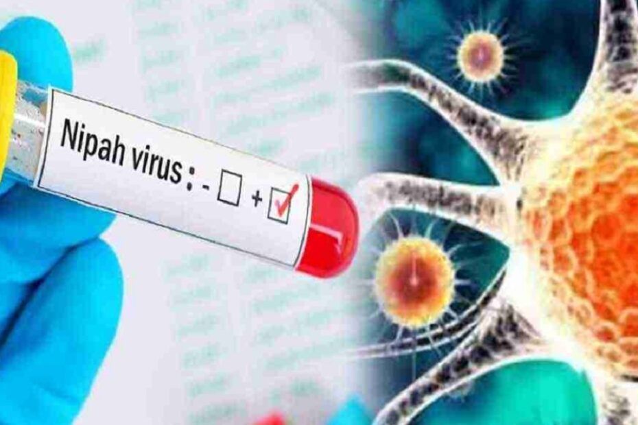 virus