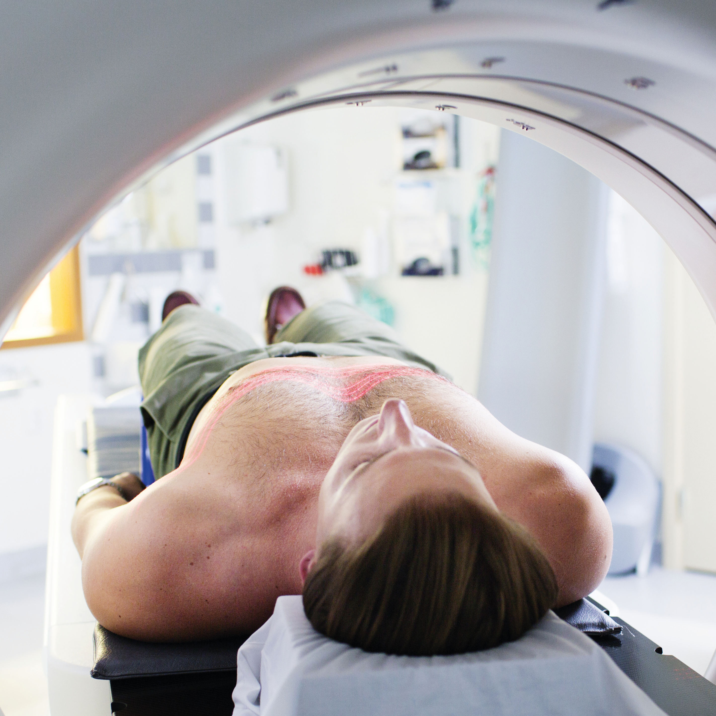 Poate radioterapia să răspândească cancerul? Descoperirea care schimbă tot ce știm despre tratamentul cancerului