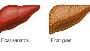 Diferența dintre un ficat normal și un ficat gras