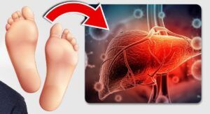 Semnele de pe picioare care indică probleme cu ficatul