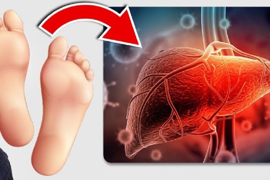 Semnele de pe picioare care indică probleme cu ficatul