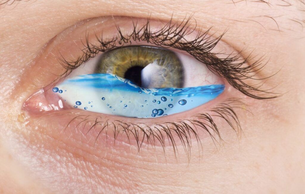 Sindromul ochiului umed (Epiphora)