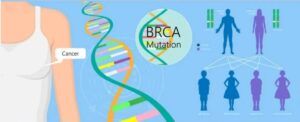 sindromul ereditar al cancerului mamar și ovarian