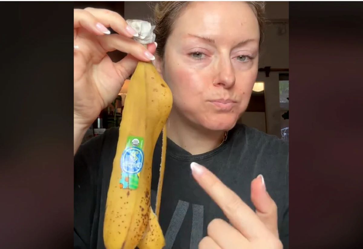 VIRAL! Coaja de banană, botox natural: elimină ridurile, cearcănele și pungile de sub ochi