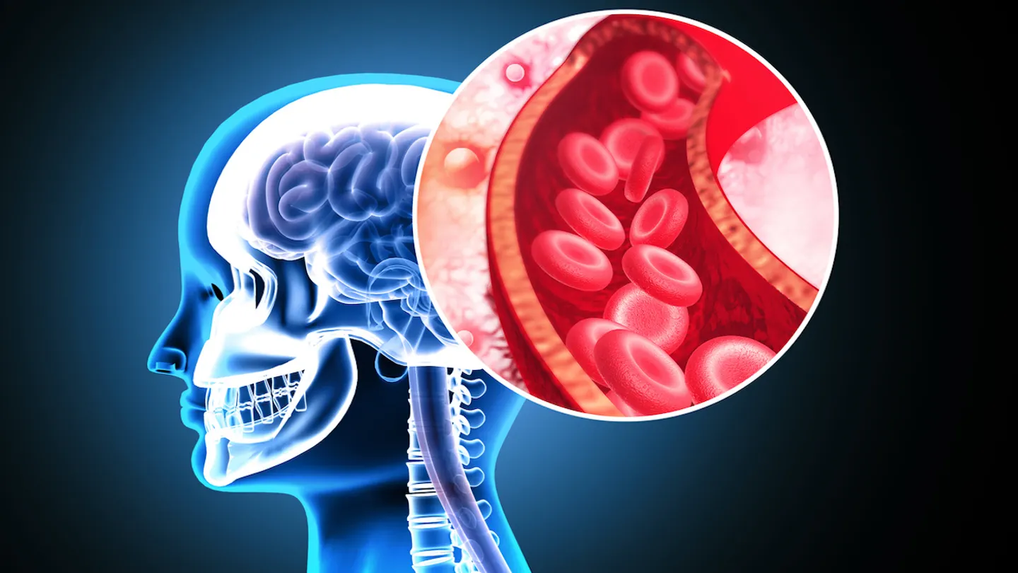 Acest nutrient simplu ar putea susține sănătatea creierului, mai ales dacă ai suferit un AVC