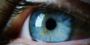 melanom ocular