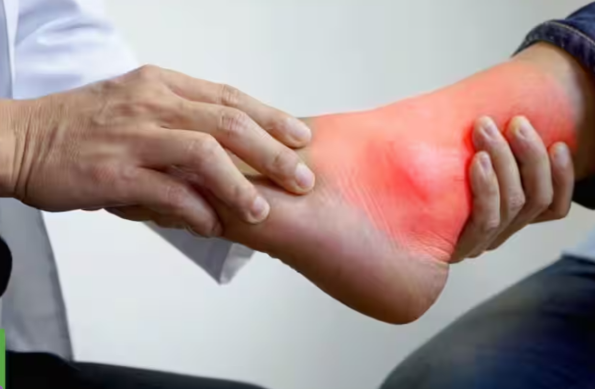 Fructul diuretic care elimină natural excesul de acid uric din organism