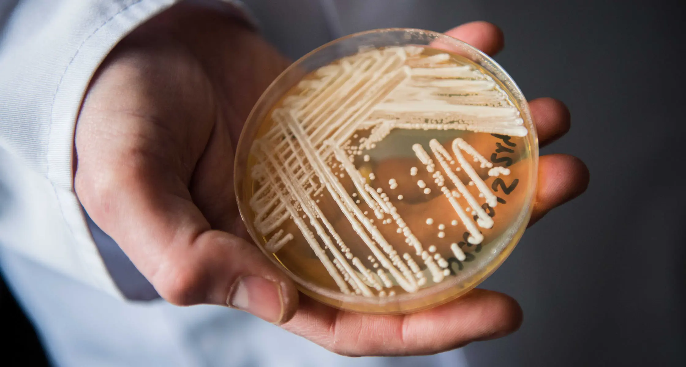 Ciuperca periculoasă din spitale