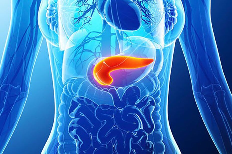 cancer pancreatic
