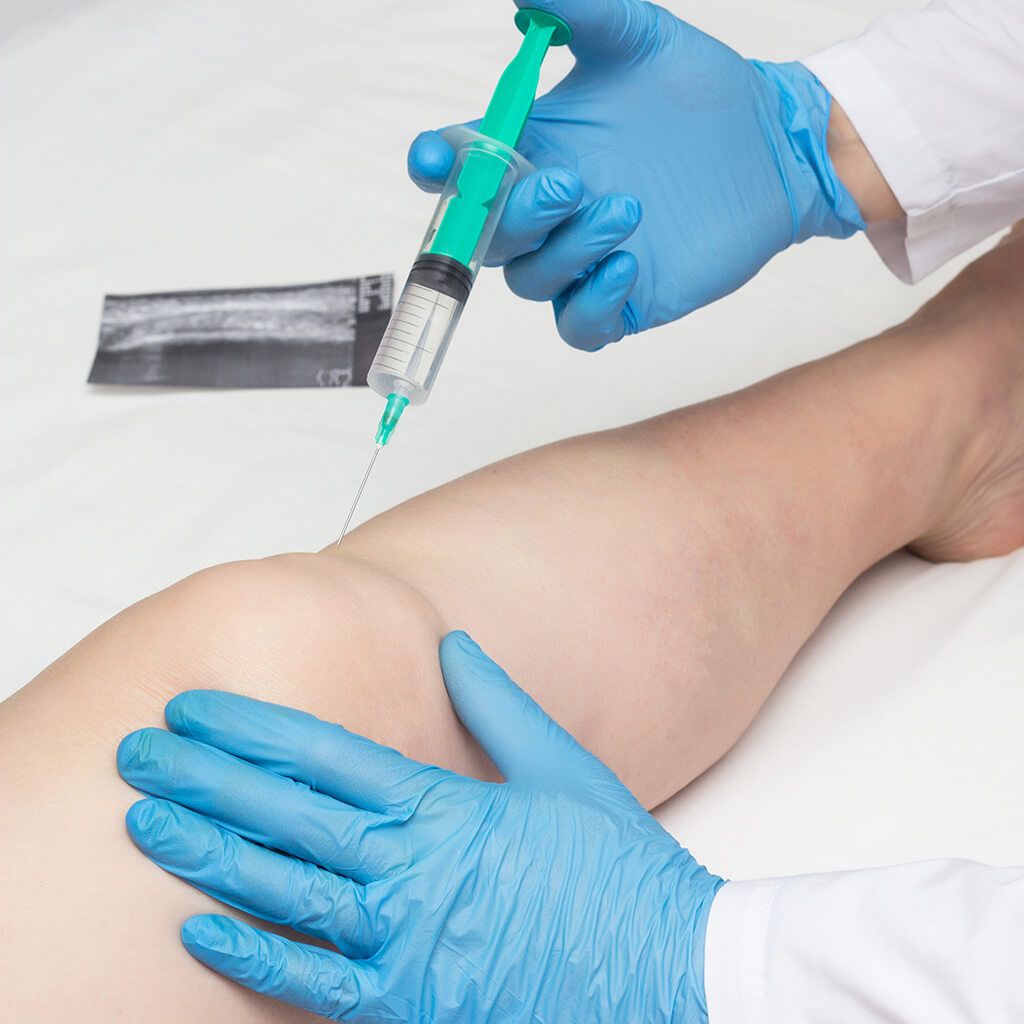 ozonoterapia