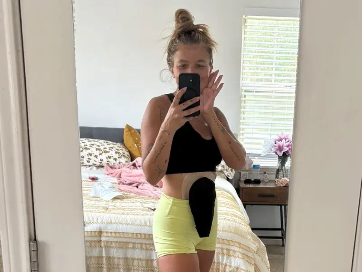 Durerea bruscă de stomac, singurul simptom al cancerului de colon în stadiul 3 al unei femei