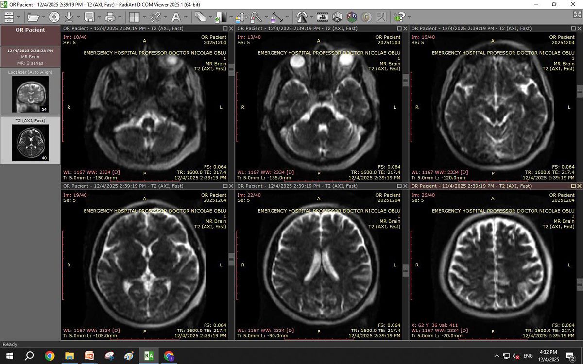 Premiera medicală națională: Diagnostic rapid cu primul RMN mobil, direct în sala de operație