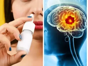 terapie cancer cerebral