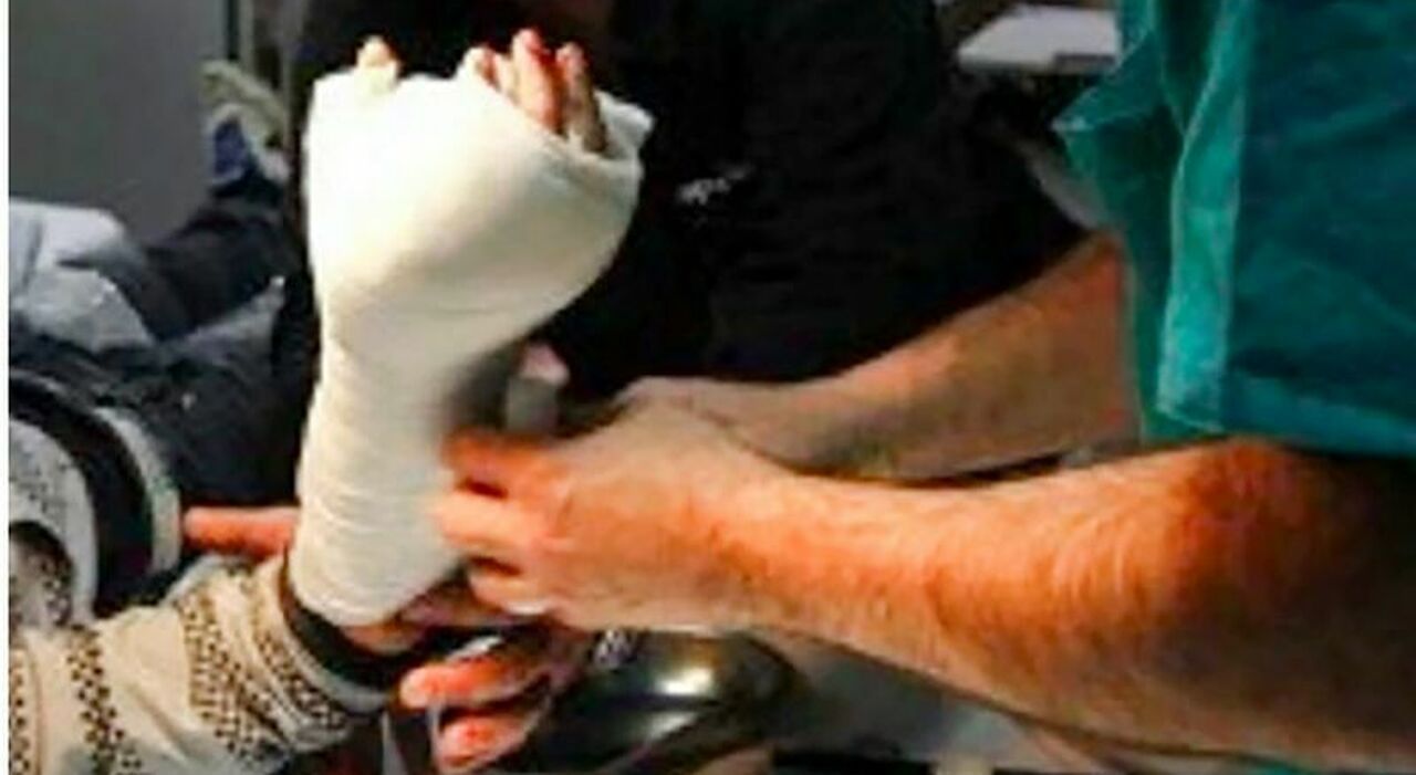 Un bărbat și-a pierdut trei degete din cauza unei petarde, apoi s-a întors în stradă și s-a rănit din nou într-o explozie