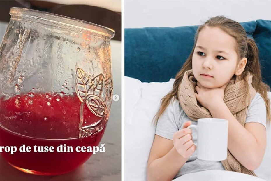 sirop de tuse din ceapa