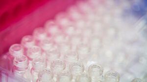 Tratament Atrofie Musculara Spinala