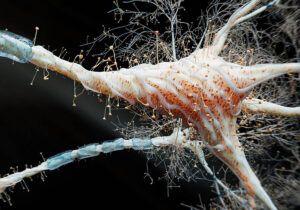 inflamatie intestinala