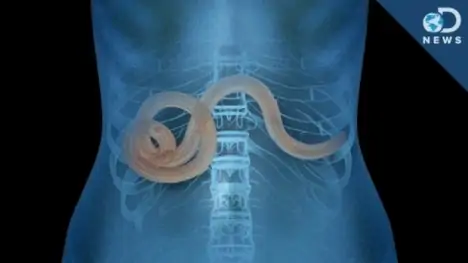 Cele mai bune tratamente pt. parazitii intestinali – pareri, pret, forum, farmacii