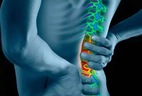 durere severă la nivelul coloanei vertebrale lombosacrale