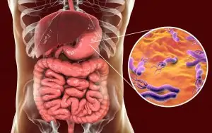 h pylori greu de pierdut în greutate