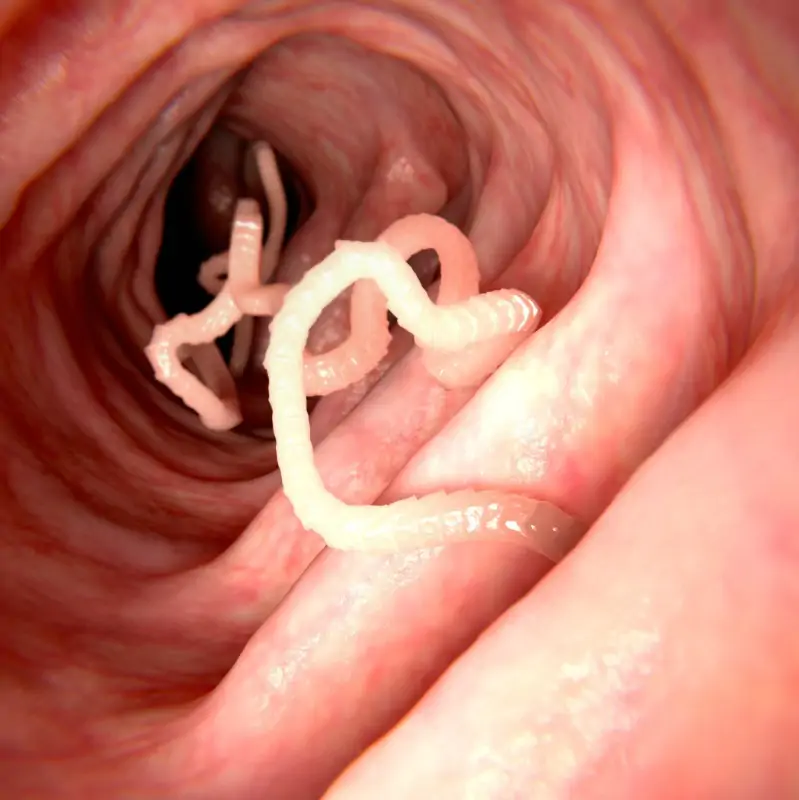 Vierme rotunde în tratamentul creierului, Viermii si parazitii intestinali